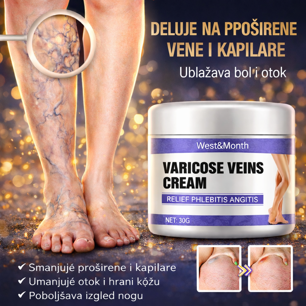 Krema protiv proširenih vena – Lakše, odmornije noge svakog dana⚡1+1 GRATIS